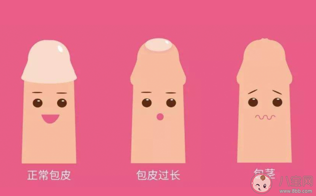 男孩包皮多长算正常 如何定义包皮过长