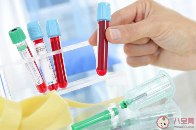 哪些检查项目抽血需要空腹 抽血化验的注意事项