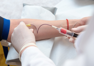 抽血前一天怎么吃更合适 空腹抽血到底要禁食多久