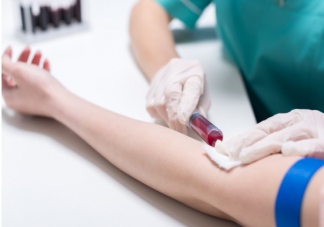 哪些检查项目抽血需要空腹 抽血化验的注意事项