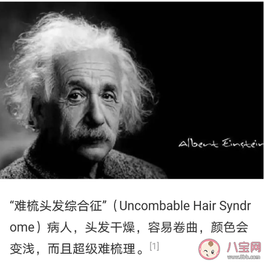 头发乱是一种病吗 头发打结梳不开怎么办