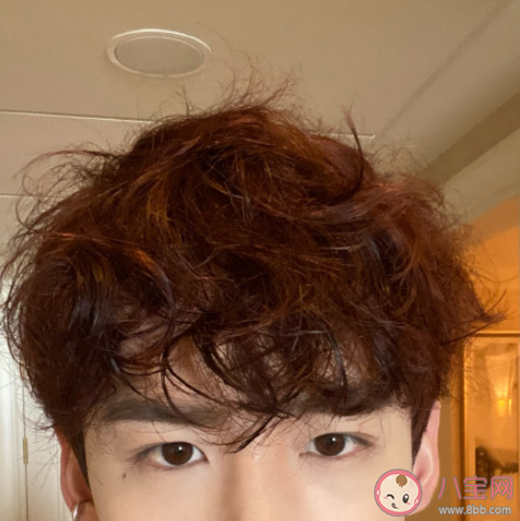 头发乱竟然是种病吗 蓬发综合征是什么意思