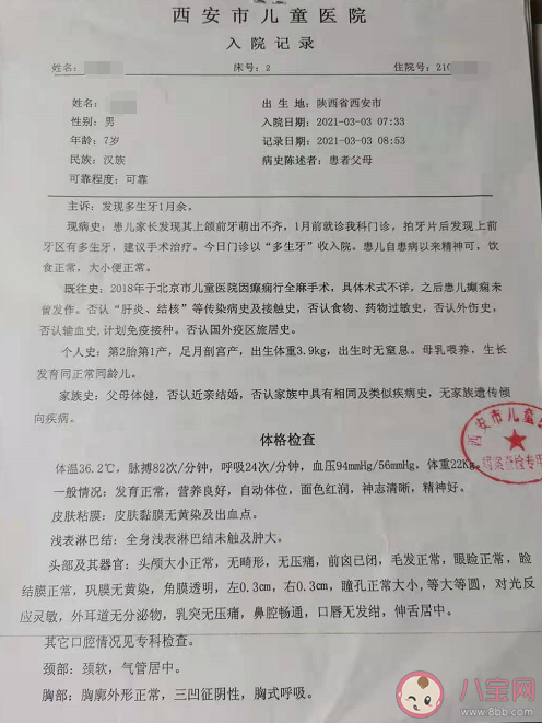 7岁男童全麻拔牙昏迷40天是怎么回事 拔牙手术需要全麻吗