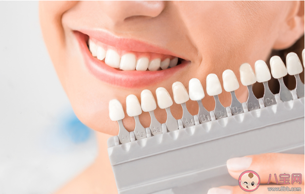 牙贴面美白牙齿好吗 牙齿贴面能维持多长时间