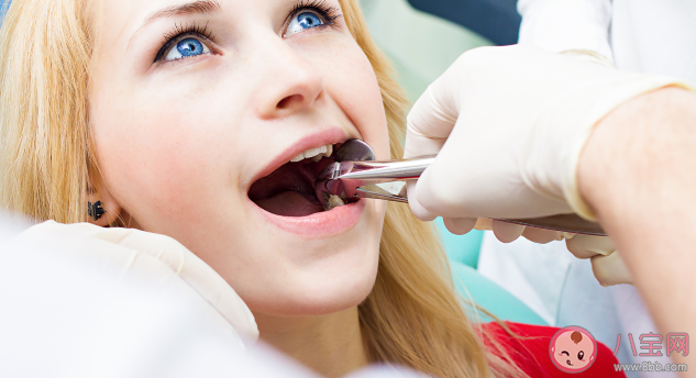 拔智齿有最佳年龄吗 拔智齿后要注意哪些事 拔智齿有最佳年龄吗 拔智齿后要注意哪些事