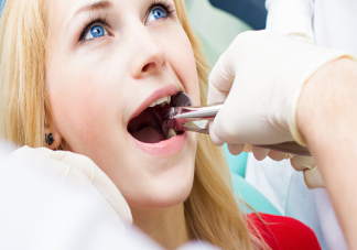 拔智齿有最佳年龄吗 拔智齿后要注意哪些事