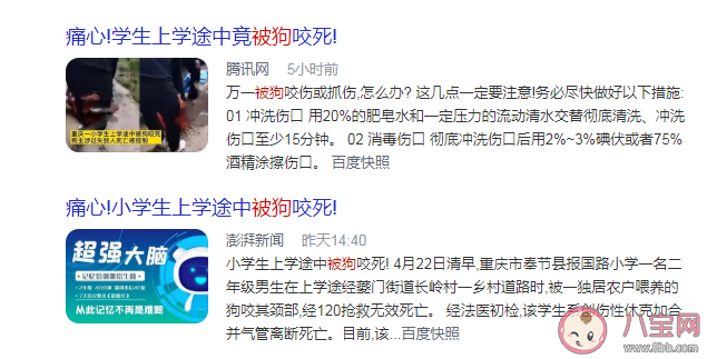 被狗咬着不放怎么办 被狗咬伤后如何正确处理伤口
