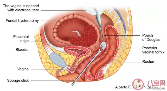 卫生棉条塞到什么位置才算放对 卫生棉条使用图解 卫生棉条塞到什么位置才算放对 卫生棉条使用图解