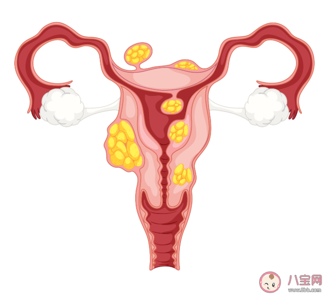 为什么卵巢癌被称为妇癌之王 卵巢癌会反复复发吗