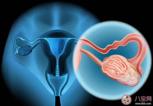 卵巢癌的高发人群是哪些 如何减少卵巢癌的发生