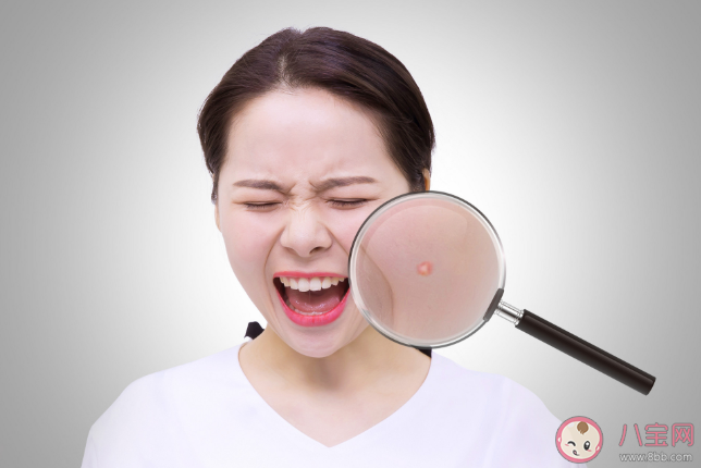 夏天为什么容易长痘 夏天如何预防长痘痘