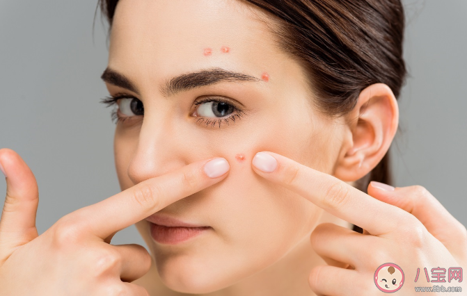 夏天为什么容易长痘 夏天如何预防长痘痘