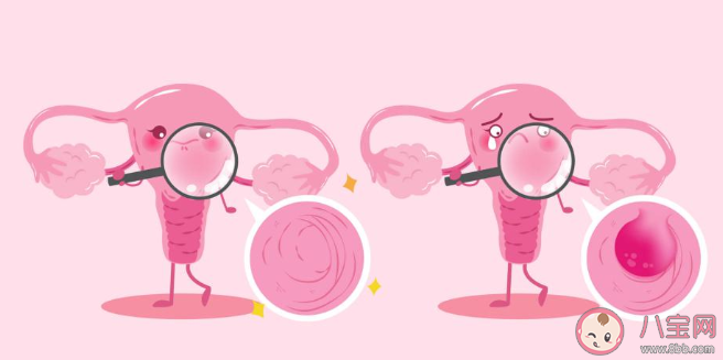 子宫内膜厚度影响怀孕吗 子宫内膜厚度多少适合受孕 子宫内膜厚度影响怀孕吗 子宫内膜厚度多少适合受孕