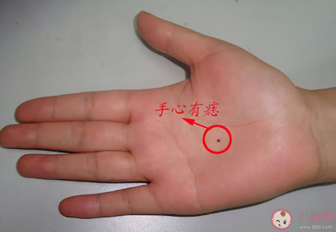 身体哪些部位上的痣一定要切除 怎么去除有问题的痣