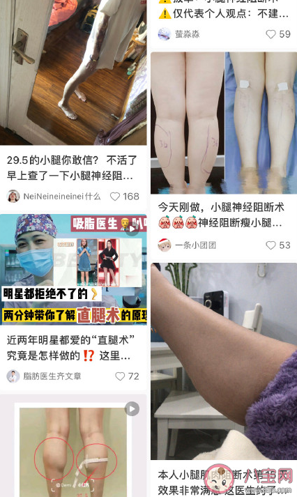 小腿肌肉阻断术瘦腿原理是什么 小腿肌肉阻断术有什么危害 小腿肌肉阻断术瘦腿原理是什么 小腿肌肉阻断术有什么危害