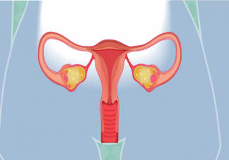 做了子宫切除术绝经会提前吗 子宫切除术切除的是哪些地方
