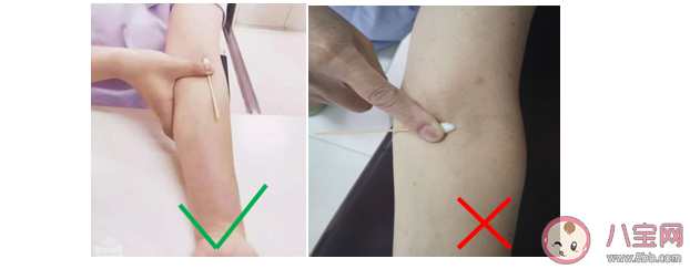 采血后为什么需要按压针口 正确的按压方式是什么