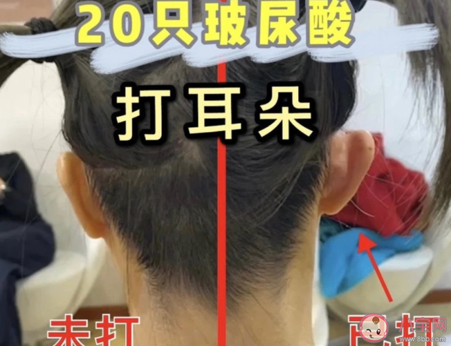 精灵耳是什么样的 为什么精灵耳能如此受欢迎