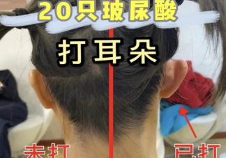 精灵耳是什么样的 为什么精灵耳能如此受欢迎