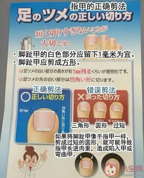甲沟炎怎么治疗才能彻底根除 甲沟炎彻底根除的方法是什么