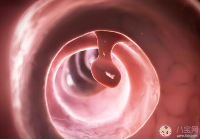 宫颈息肉不治疗会自己消失吗 宫颈息肉有什么危害