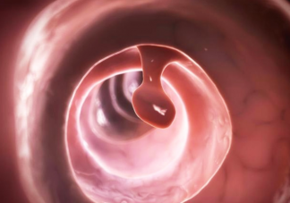 宫颈息肉不治疗会自己消失吗 宫颈息肉有什么危害