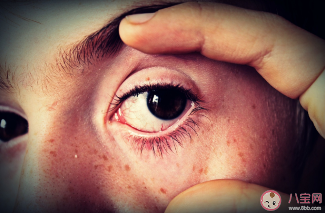 蚂蚁庄园6月10日问题答案:只有老年人才会得白内障吗 蚂蚁庄园6月10日问题答案:只有老年人才会得白内障吗