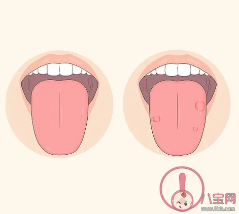 除了牙齿舌头也需要经常清洁吗 蚂蚁庄园今日6月11日答案