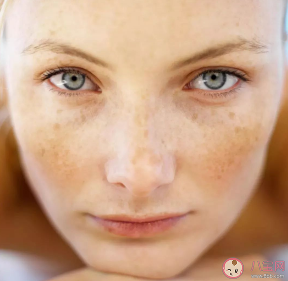 皮肤越黑越容易晒黑吗 皮肤是怎样变黑的