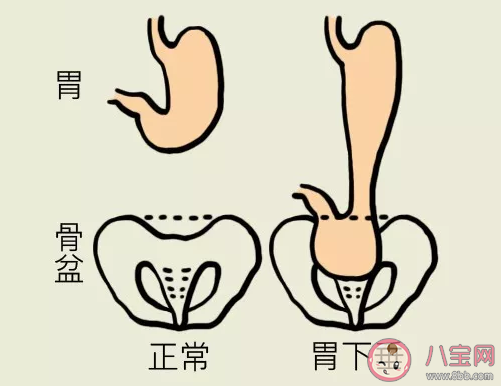蚂蚁庄园饭后立即运动会导致胃下垂这种说法 小课堂6月17日答案