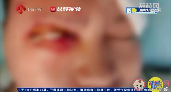 睡觉时充电器爆炸险失明是怎么回事 睡觉时充电安全吗