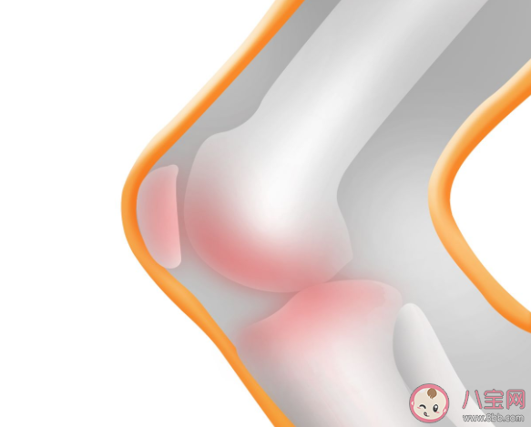 骨质疏松真的和缺钙有关吗 骨质疏松和哪些因素有关 骨质疏松真的和缺钙有关吗 骨质疏松和哪些因素有关