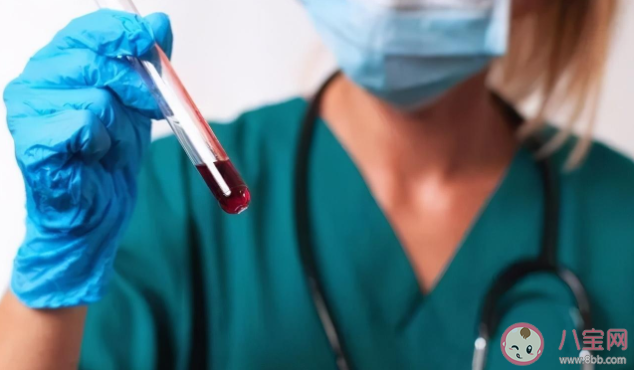 血液生化21项都要做吗 血液生化检查前做哪些让检查结果更准确
