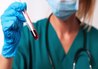 血液生化21项都要做吗 血液生化检查前做哪些让检查结果更准确
