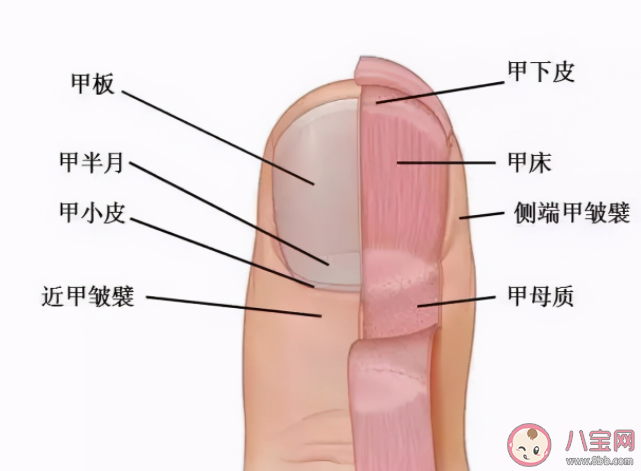 指甲太短容易得甲沟炎吗 甲沟炎有什么办法好转