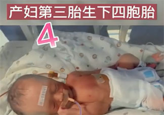 新乡一产妇第三胎生下龙凤四胞胎 怀了多胞胎要注意些什么