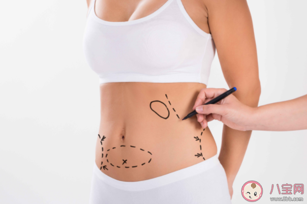 抽脂减肥还会胖回来吗 抽脂手术有哪些副作用风险