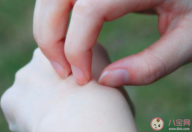 北京首次发布蚊虫叮咬指数 蚊虫叮咬共分为哪几个等级