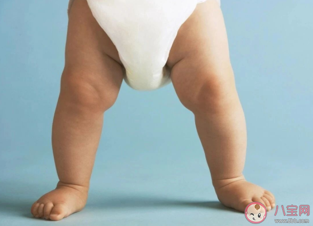 孩子站得早会变O/X型腿吗 怎么预防宝宝出现不正常的腿型