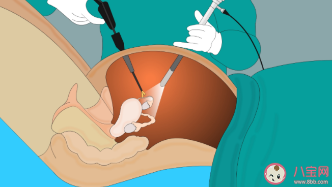 做宫腔镜检查会影响生育吗 什么时候做宫腔镜效果最好 做宫腔镜检查会影响生育吗 什么时候做宫腔镜效果最好