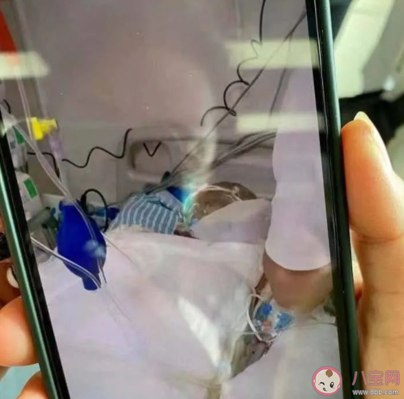 医生科普烧伤后如何自救 应对烧烫伤的五个规定动作