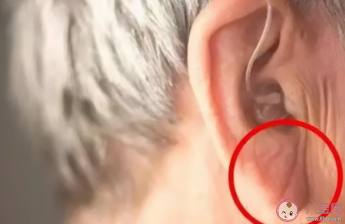 耳垂上有褶是心脏病的征兆吗 心脏病出现问题哪些先兆需要警惕