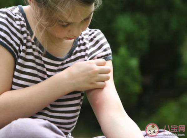 被蚊子咬了掐十字能止痒吗 涂口水可以止痒吗
