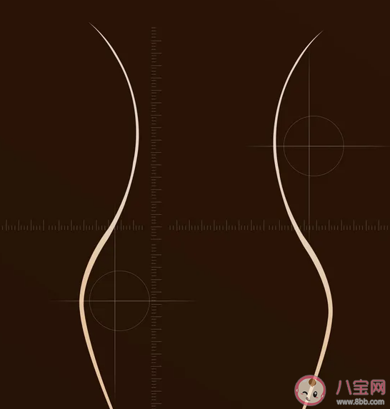 吸脂以后会不会导致皮肤松弛下垂 哪些部位可以吸脂 吸脂以后会不会导致皮肤松弛下垂 哪些部位可以吸脂