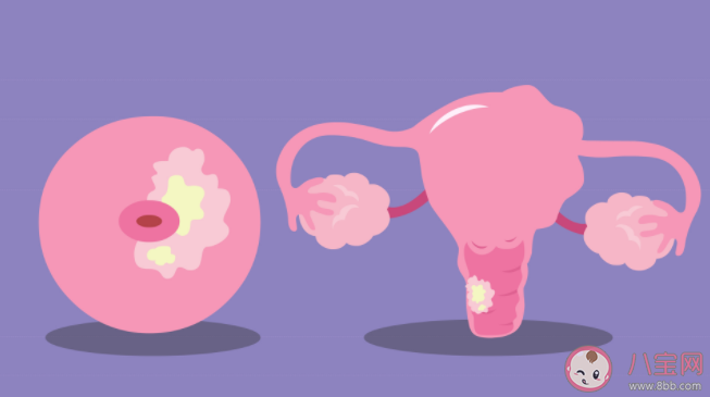 宫颈糜烂会危害身体健康吗 宫颈糜烂会有哪些危害