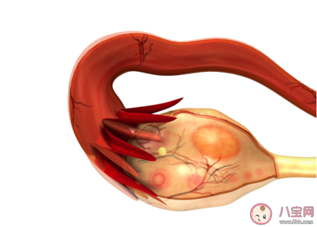 卵巢囊肿会影响生育吗 卵巢囊肿和性生活有关系吗 卵巢囊肿会影响生育吗 卵巢囊肿和性生活有关系吗