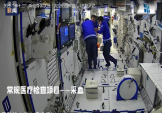3名航天员太空采血做超声和地面有什么不同 在太空生病了该怎么办