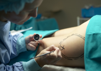 抽脂手术是不是减肥 什么情况不适合做抽脂手术