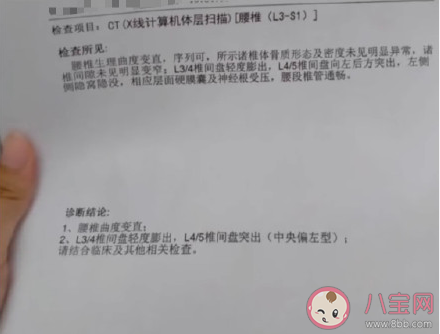 侧卧睡带来的危害是什么 10种疾病的专属睡姿 侧卧睡带来的危害是什么 10种疾病的专属睡姿