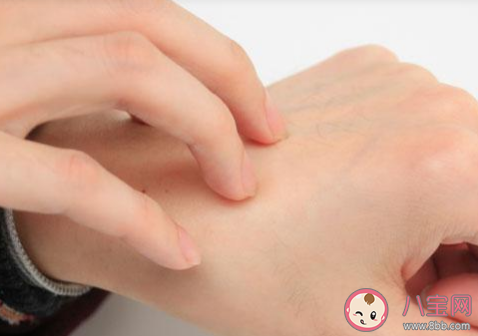 被蚊子咬了用指甲在蚊子包上画十字止痒是好方法吗 蚂蚁庄园8月15日答案